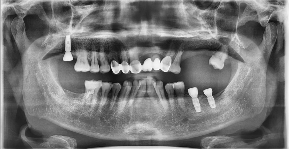 panoramic radiograph.